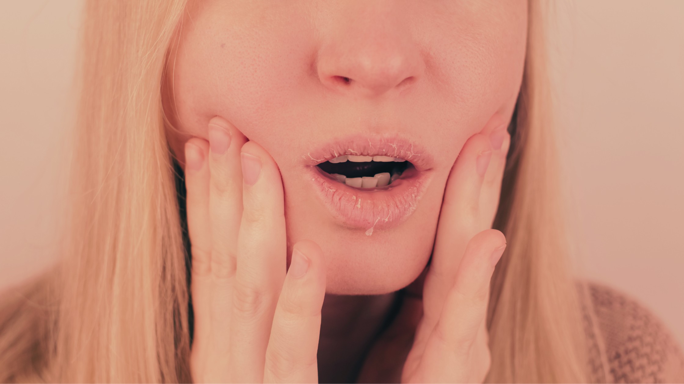 Dry Lips In Winter Simplifying Skincare